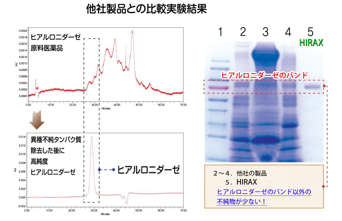 HIRAX 他社比較