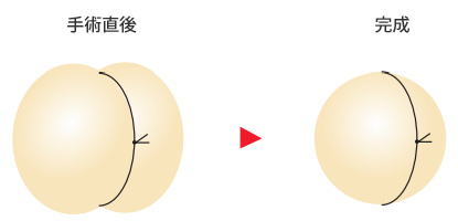 ちょうどよい結び具合