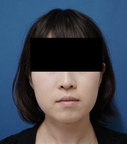 ?1ヶ月後