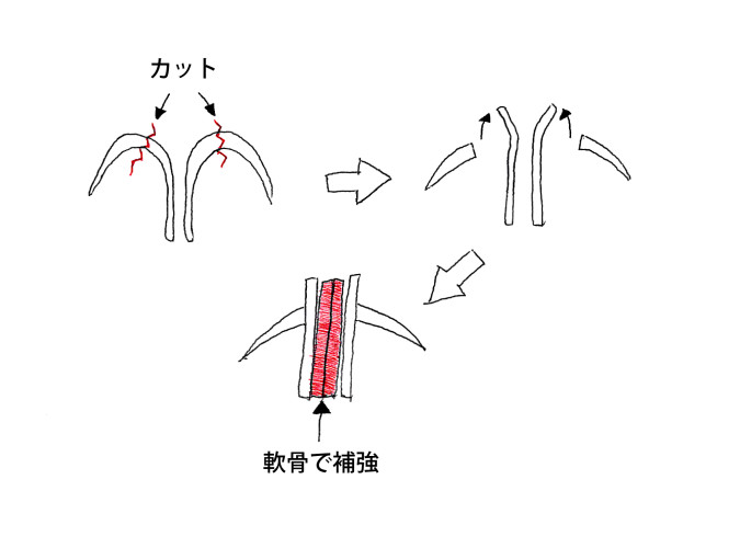 オペ手順?