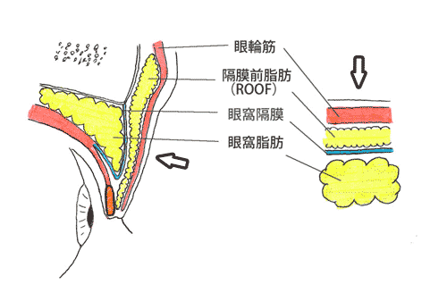 上瞼の筋肉や脂肪の構造（断面図）