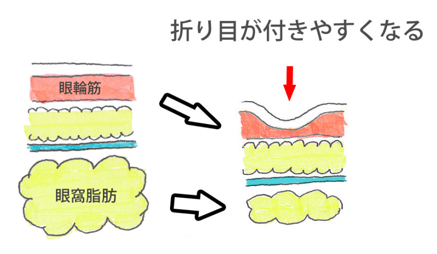 厚み取り図