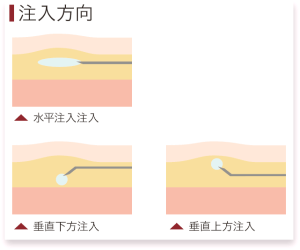 hyaluronsan_condense-02