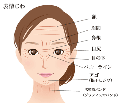 しわ治療の基本-表情じわ名前