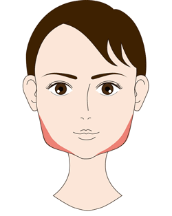 強力小顔３点セット　エラ筋肉イラスト