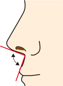 鼻唇角、鼻柱口唇角のイラスト
