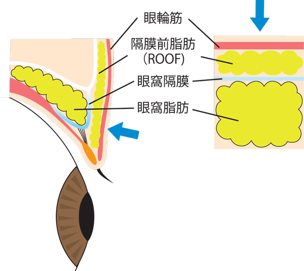 まぶたの厚み・構造の図