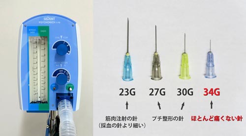 眼窩脂肪の除去では痛みを軽減する工夫も行っている