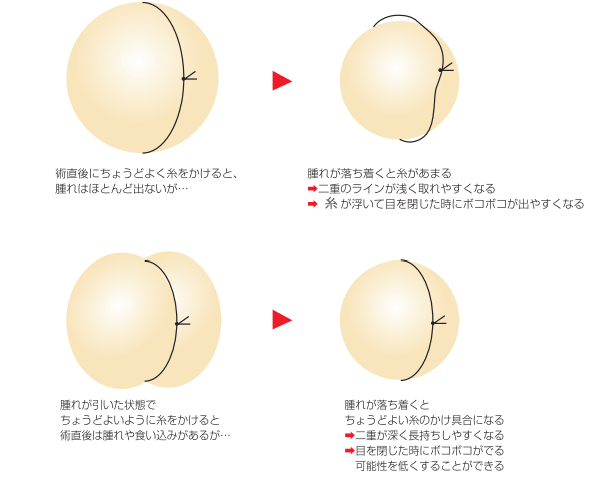 糸の締め具合イメージ