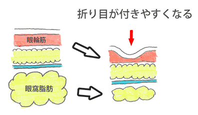 厚みとりで折り目がつきやすくなるイメージ