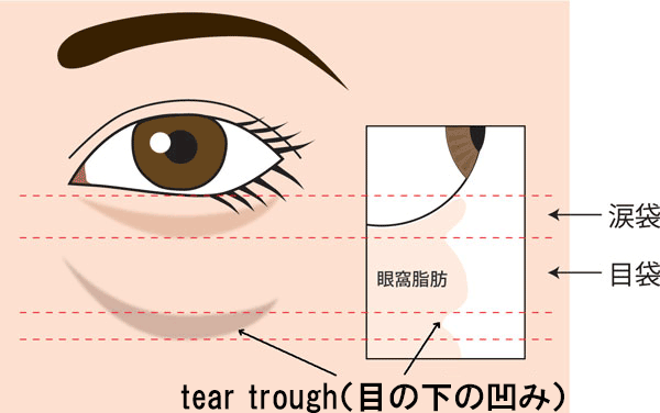 目の下の凹み