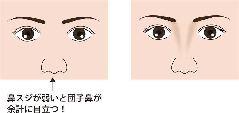 鼻尖縮小術-鼻筋あるなし