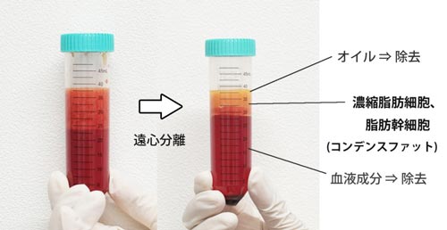 不純物を飛ばしたコンデンス脂肪の図