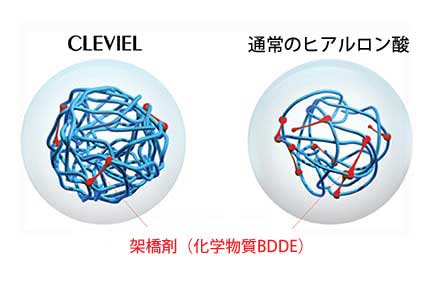 クレヴィエル 高密度化