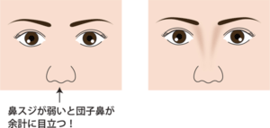 鼻スジが弱い団子鼻が目立つイメージ