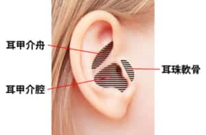 耳介軟骨採取部分