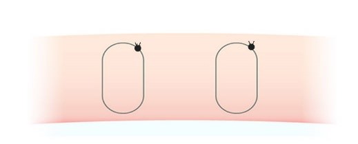 埋没法2点止めの図