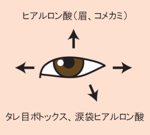 目を上下左右に大きくする（プチ整形）