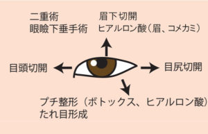 目の方向別、目を大きくする施術。