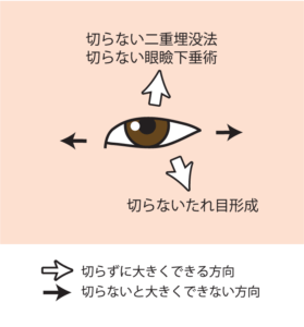 ドクター直伝 目を大きくする方法を徹底解説 理想の目に近づける もとび美容外科クリニック