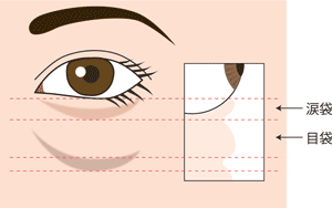 二重 目の大きさ 涙袋に左右差ができる原因と対処法 もとび美容外科クリニック