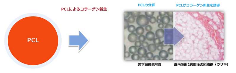 PCLによるコラーゲン生成図