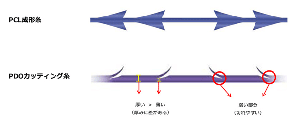 VOVリフトのトゲ（コグ）の図