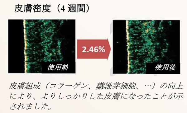 ベビーエッセンス皮膚密度症例