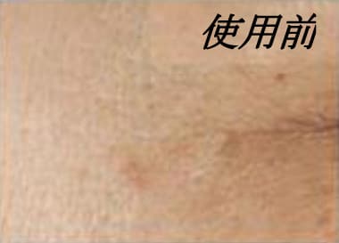 ベビーエッセンス 目尻のしわのBefore写真