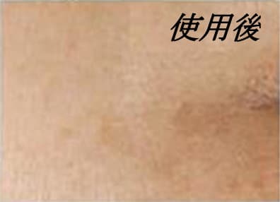 ベビーエッセンス 目尻のしわのAfterの写真