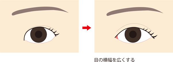 目の幅が狭くてお悩みの方へ 目の横幅を広くする方法 東京新宿の美容整形ならもとび美容外科クリニック