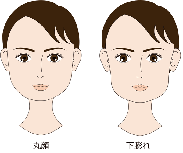 下膨れ顔 丸顔で顔が大きく見える原因と対処法 キレイな卵形へ 東京新宿の美容整形ならもとび美容外科クリニック