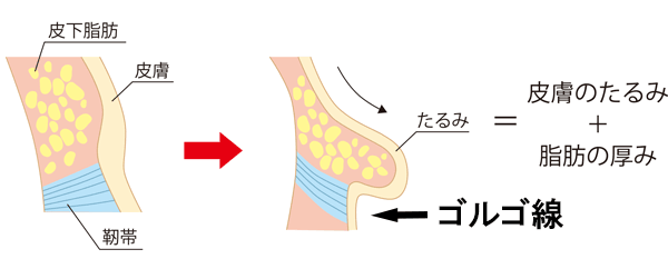 ゴルゴ線断面図