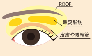 まぶたの部位別脂肪