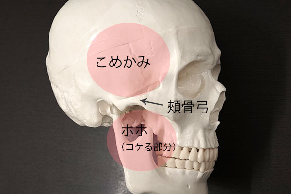 こめかみがくぼんで老けて見える時の改善方法 東京新宿の美容整形ならもとび美容外科クリニック