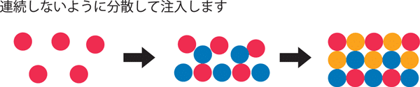 連続しないように分散して脂肪を注入