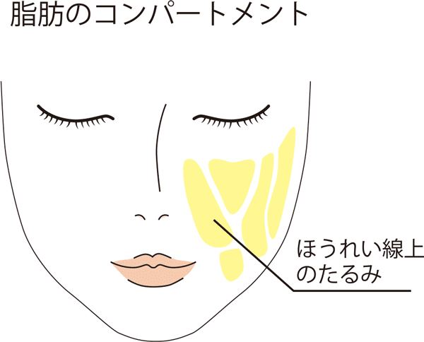 脂肪のコンパートメント　ほうれい線のしわ