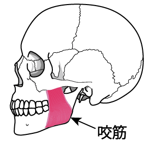 頭蓋骨横　エラの悩み　咬筋