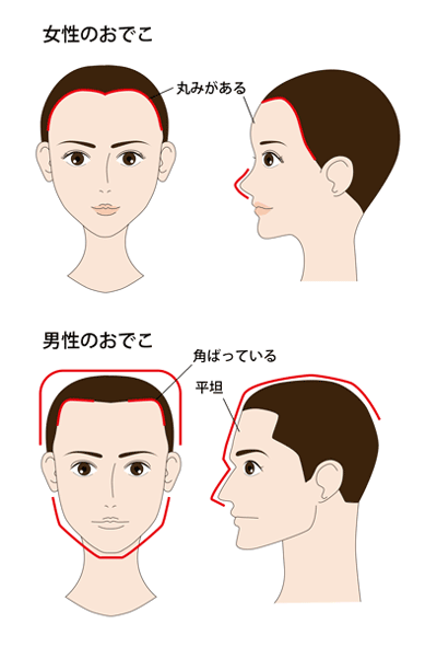 女性のおでこ　男性のおでこ 　おでこ図解