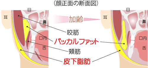 小顔になりたい ホホ アゴ下 ほうれい線上の気になる脂肪を取る方法 東京新宿の美容整形ならもとび美容外科クリニック