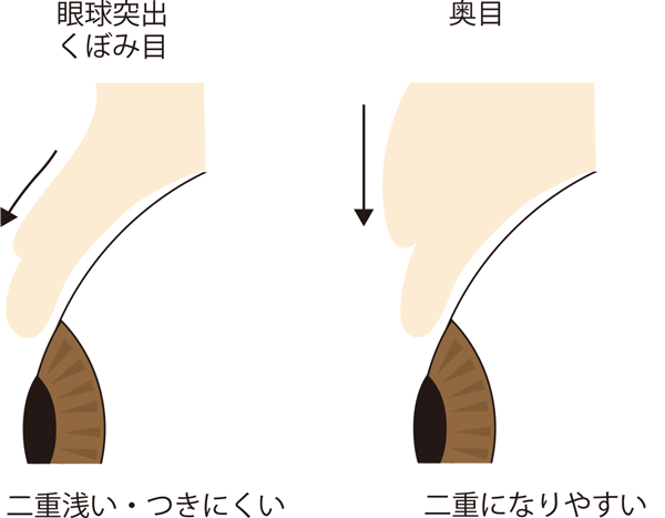 くぼみ目と奥目