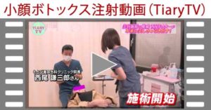 小顔ボトックス注射　TV紹介動画