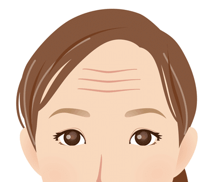 おでこ（額）のしわが目立つ時の解消方法まとめ