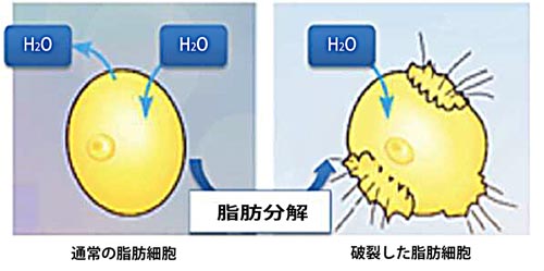 低張性の脂肪分解-カベリン