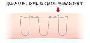 もとびアイゴールド厚みとり