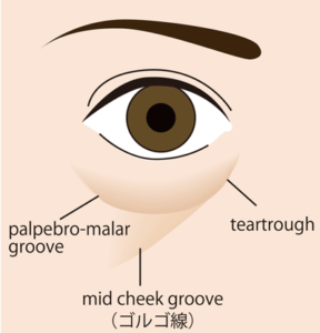 目の下の凹みの名称