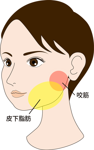 脂肪溶解注射のイメージ