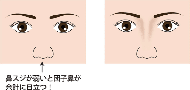 鼻スジがないと鼻先・小鼻が余計に目立つことを解説する図