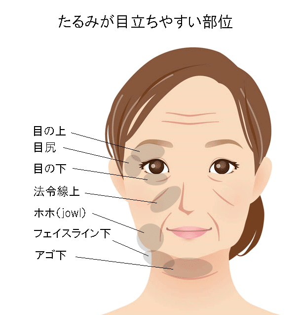 たるみが目立ちやすい部位