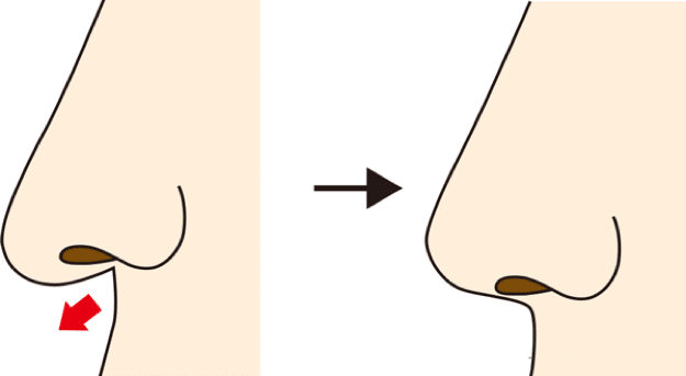 鼻柱基部が引っ込んでいるイメージ